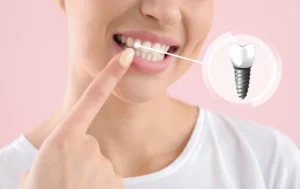 implantátum elhelyezése